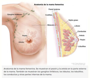 cancer de mamas