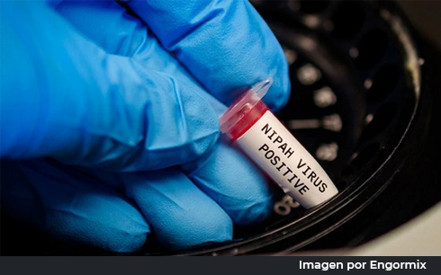 Virus Nipah